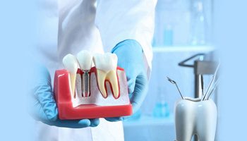 Dental Implants and Bone Health: Maintaining a Strong Foundation